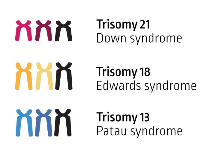 Trizomije
